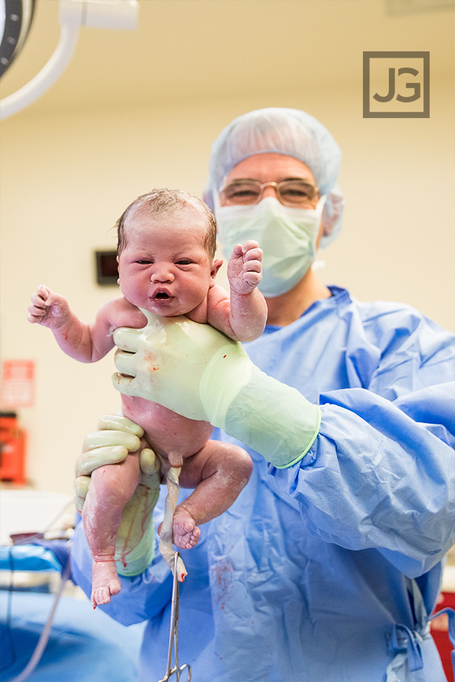 birth photography c-section surgery
