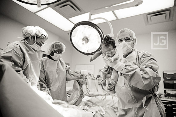 Read more about the article Remy | Birth Photography of an Emergency C-Section